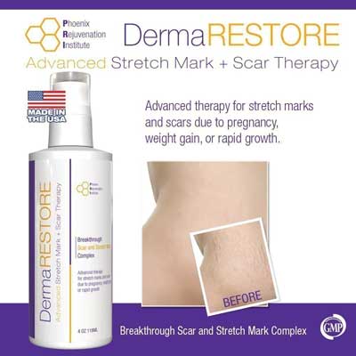 PRI Dermarestore- The #1 Clinically proven stretch Mark and Scar Treatment